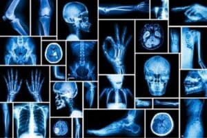 Exámenes de imágenes diagnósticas